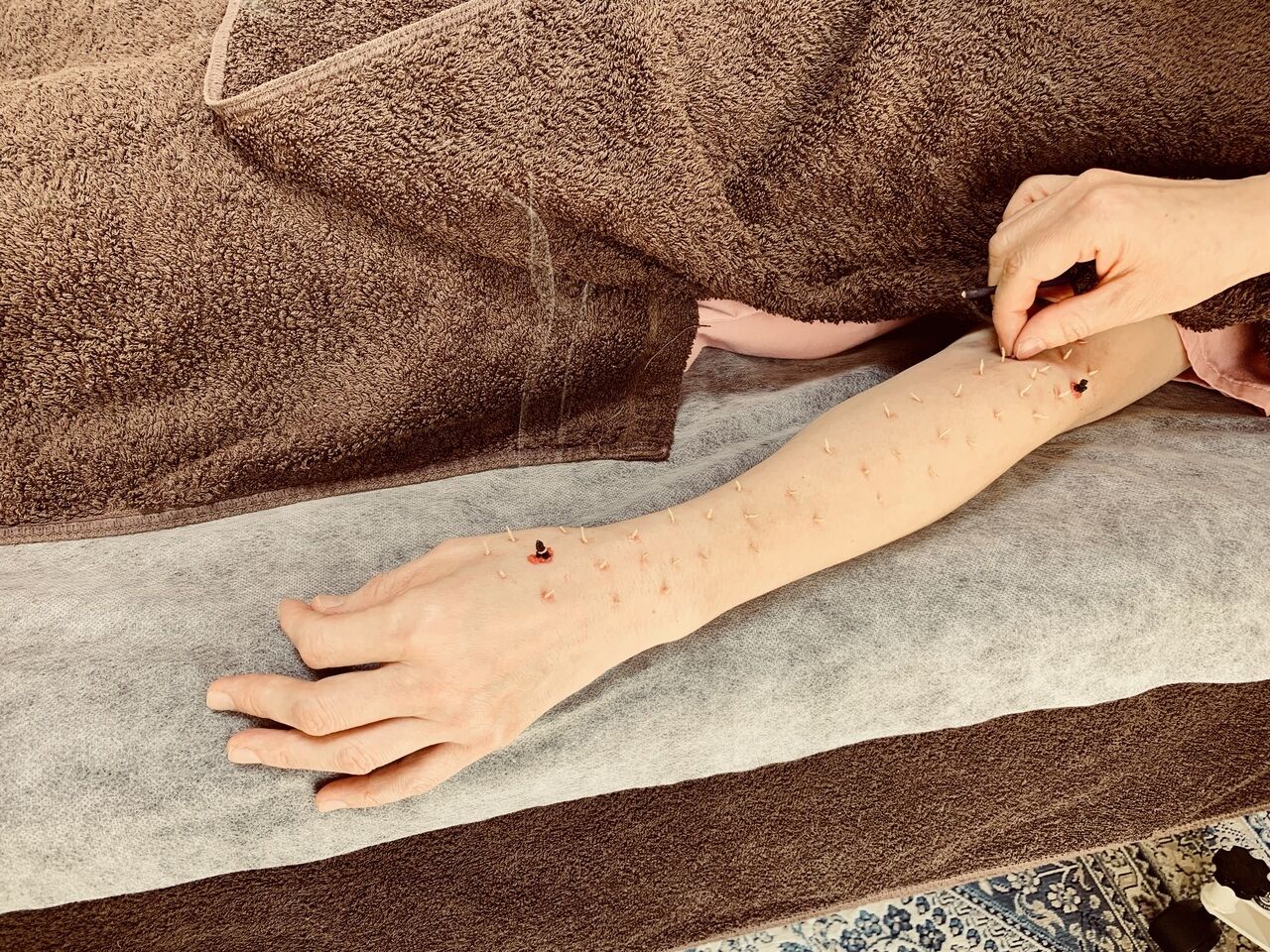 40℃前後の温かいお風呂に入っている様な温度で治療をしていきます。